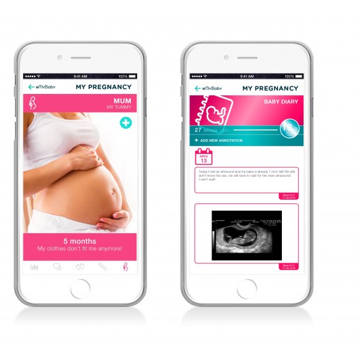 Портативний фетальний доплер для вагітних Sweetbeat